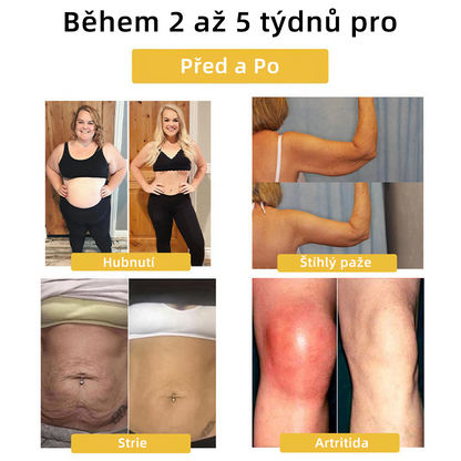 𝘾𝙕𝙏𝙄𝘾𝙇𝙀®Last day of the promotion — 50% OFF🔥𝗠𝗼𝗶𝘀𝘀𝗮𝗻𝗶𝘁𝗲 𝗠𝗮𝗴𝗻𝗲𝘁𝗼𝘁𝗵𝗲𝗿𝗮𝗽𝘆 𝗗𝗶𝗮𝗺𝗼𝗻𝗱 𝗥𝗶𝗻𝗴💎