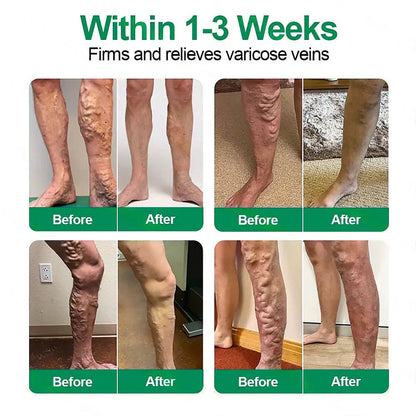 𝓞𝒇𝒇𝙞𝒄𝙞𝒂𝒍 𝑺𝒕𝙤𝒓𝓮 | 𝐅𝗹𝒐𝐫𝐢𝒔𝗺𝙖® 𝐕𝗲𝐢𝐧𝐓𝙖𝐫𝐠𝗲𝐭 𝐍𝒂𝐧𝐨 𝐌𝐢𝐜𝐫𝐨𝐧𝗲𝗲𝐝𝗹𝐞 𝐏𝙖𝐭𝐜𝐡🌿Instant Relief, Long-Term Results